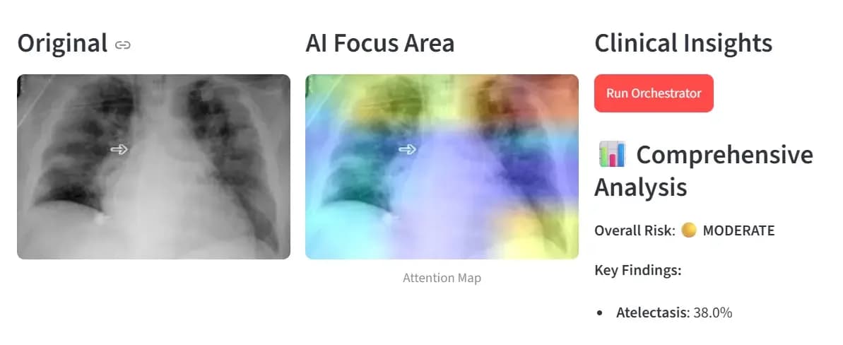 AI-Powered Medical Diagnostic System